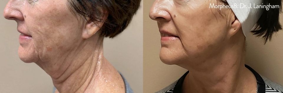 Before And After | Absolute Health Care | Newnan GA