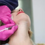 Kybella by Absolute Healthcare of Ga inc in Newnan, GA