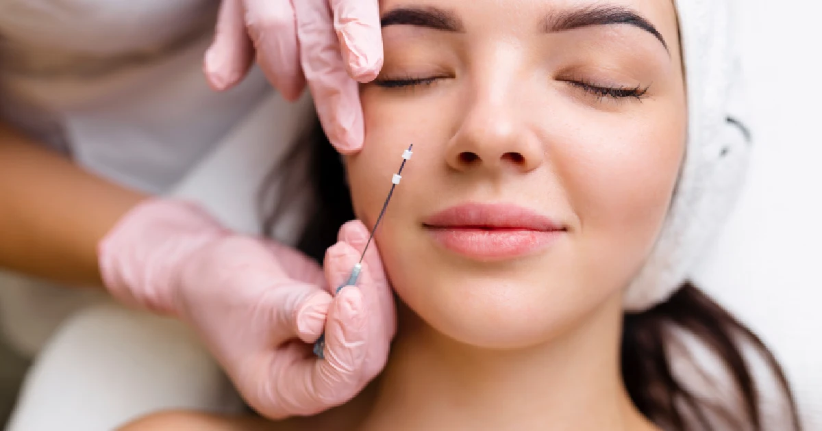 woman receiving a PDO thread lift procedure in Newnan, Georgia