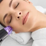 Women Receiving Morpheus8 Treatment in Newnan And Griffin
