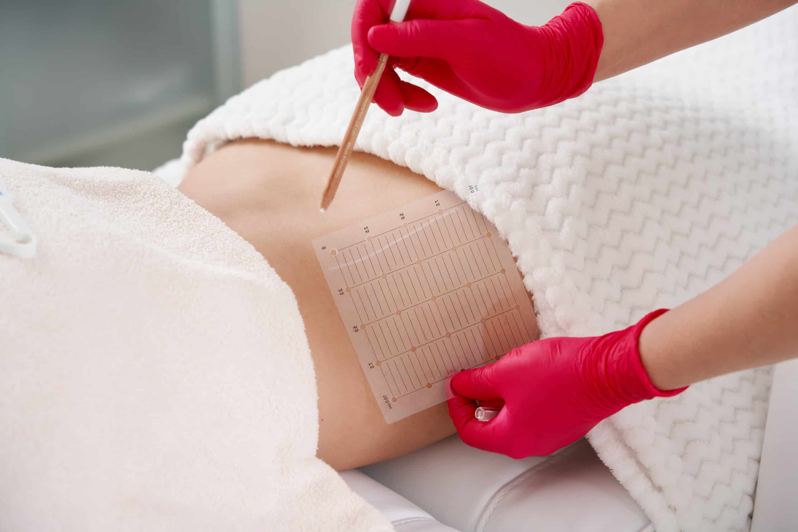 PRP/PRF Therapy | Absolute Health Care | Newnan GA
