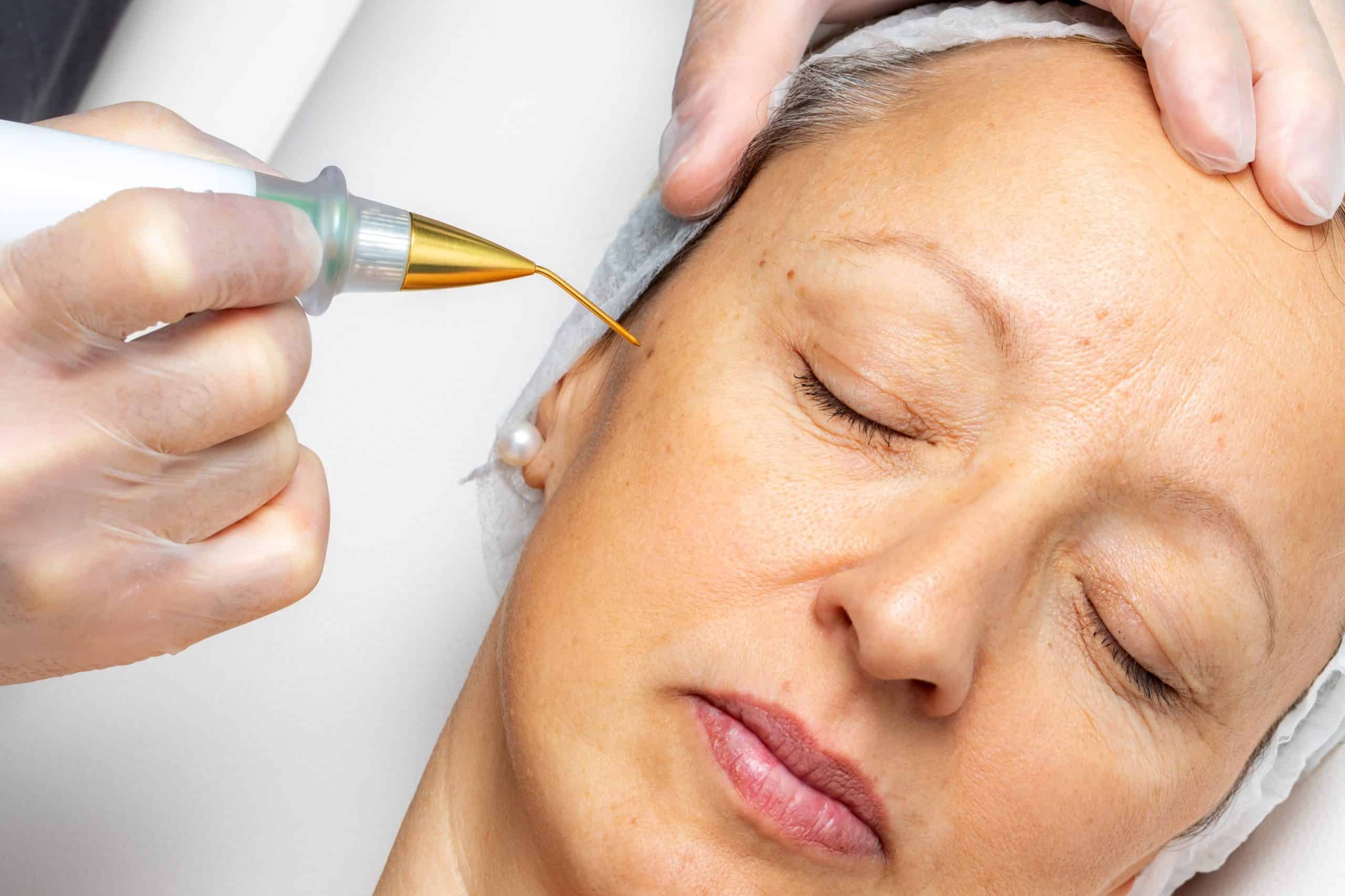 Safety Considerations for Plasma Ion Technology Devices for Skin