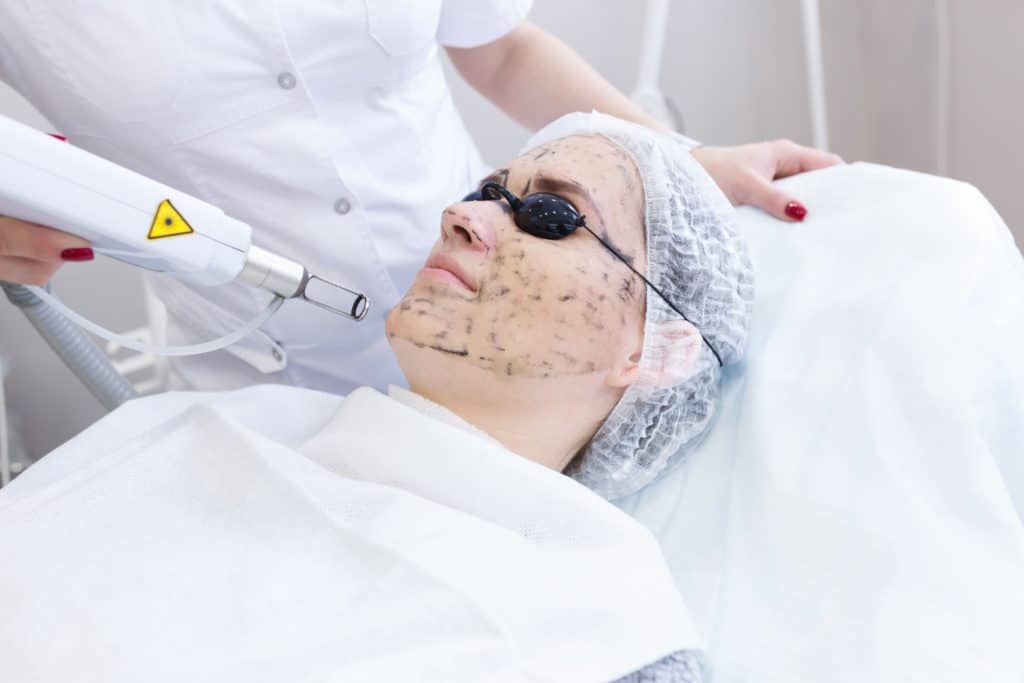 Different Types of Chemical Peels Which One is Right for You