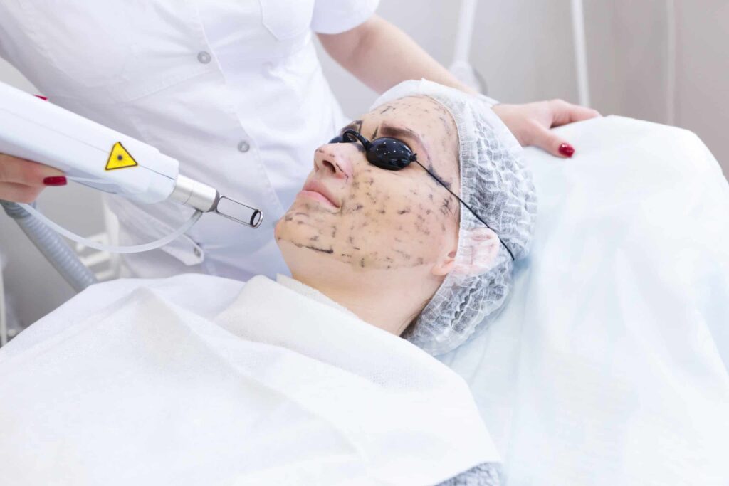 Different Types of Chemical Peels Which One is Right for You